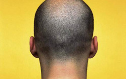 kratzen von körperteilen